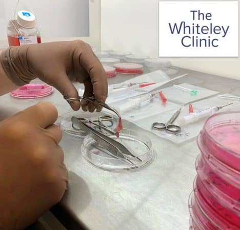 Testing liquid sclerotherapy in veins at The Whiteley Clinic research laboratory into venous disease and treatements