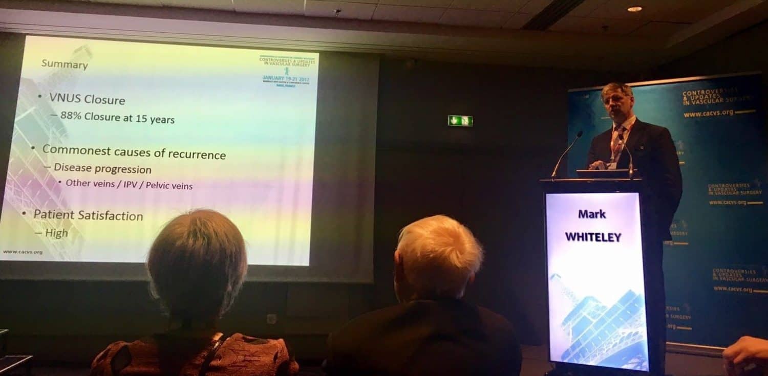 Prof Mark Whiteley lecturing in Paris at CACVS presenting his 15 years results for varicose veins endovenous treatment Jan 2017