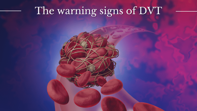 The Warning signs of DVT