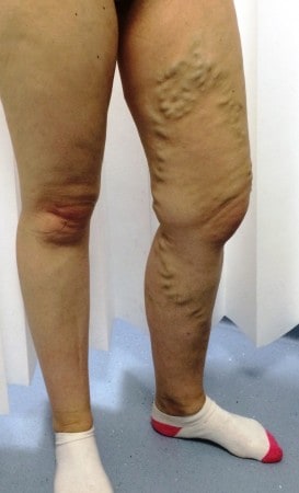 A second opinion from The Whiteley Clinic identified a misdiagnosis for this patient