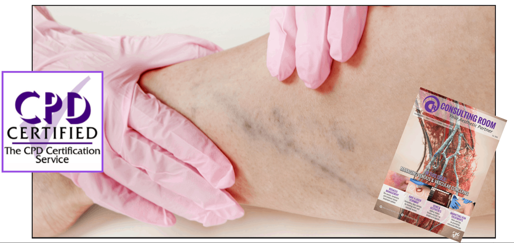 Featured in the Consulting Room Magazine, Professor Mark Whiteley discusses why adding vein-related treatmentents to a clinical practice might not be as it sounds.