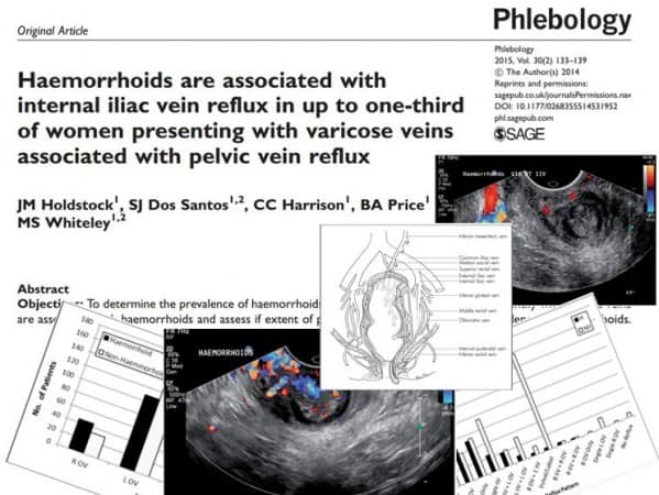 Haemorrhoids new research - haemorrhoids or piles are part of Pelvic Varicose Veins - Revolutionary Research from The Whiteley Clinic