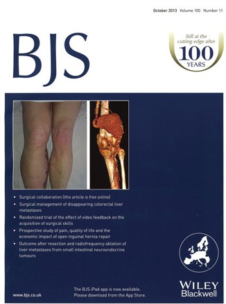 Stripping Varicose Veins - Varicose Veins that are stripped only grow back again - 1 Year Results in the British journal of Surgery