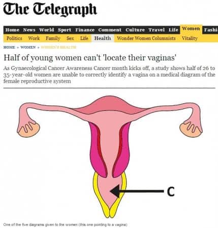 Prof Mark S Whiteley quoted in The Telegraph about varicose veins of vagina and vulva.