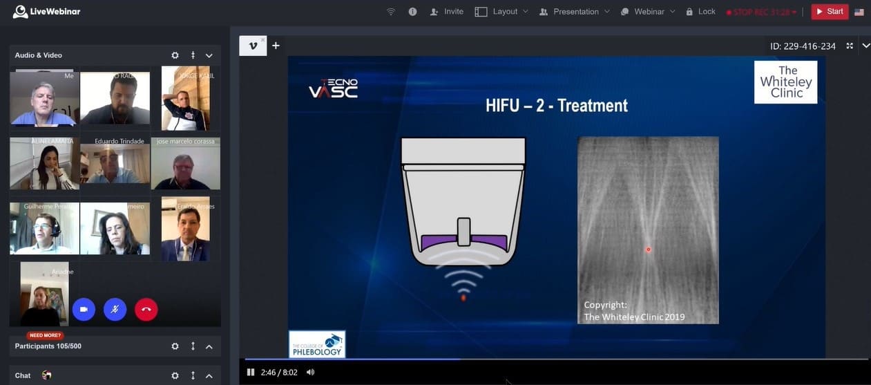 HIFU treatment of varicose veins &ndash; presented at Technovasc 2020 by Mark Whiteley