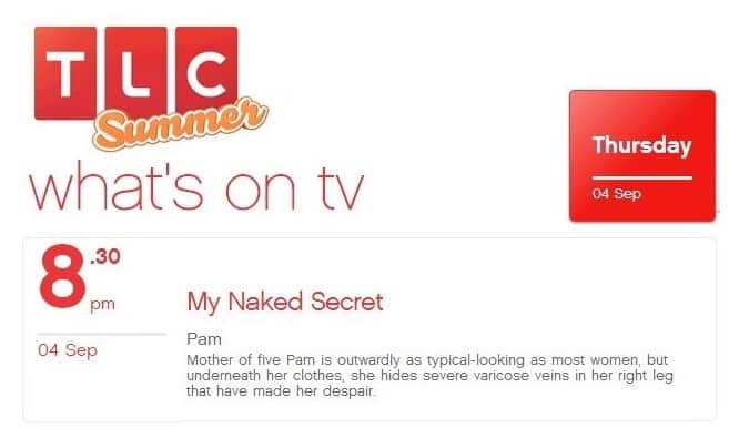 The Learning Channel - Varicose Veins of Pelvis and Legs cured on TV by Prof Mark Whiteley of The Whiteley Clinic