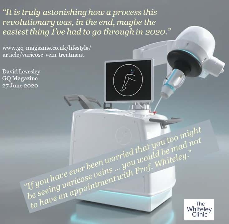 Report on having HIFU Sonovein varicose veins treatment by David Levesley GQ Magazine