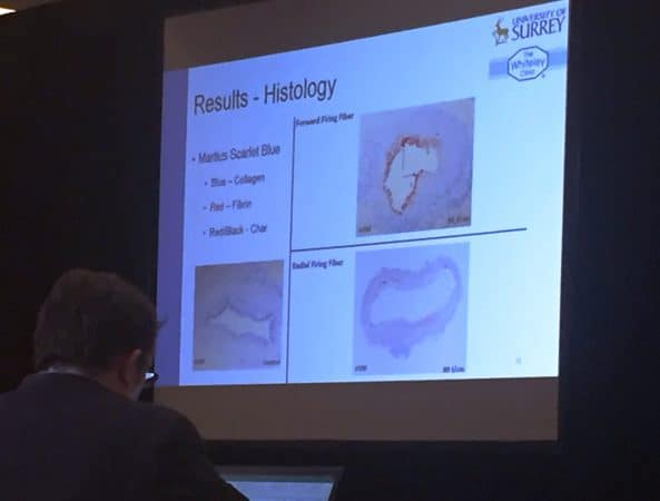 Harry Ashpitel PhD student at The Whiteley Clinic shows research slides about EVLA for varicose veins research at AVF in USA 14th Feb 2017