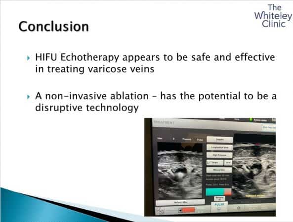 Conclusion of the prize winning talk on HIFU Echotherapy treatment of Varicose Veins using Sonovein