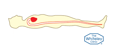 Animation of heart pumping blood through arteries