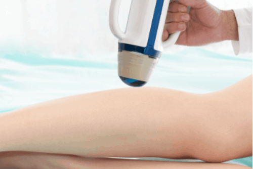 SONOVEIN – The latest non-invasive treatment option for Varicose Veins offered exclusively at The Whiteley Clinic