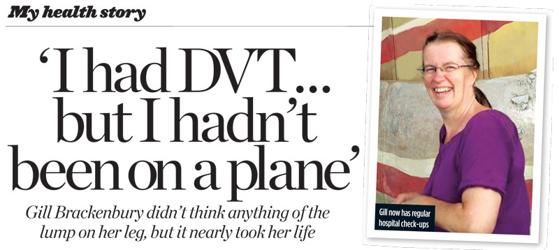 Life-saving deep vein thrombosis diagnosis for Gill Brackenbury by Professor Mark Whiteley
