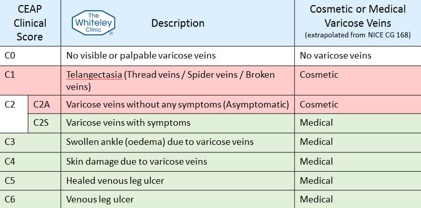 Cosmetic Varicose-Veins or Medical Varicose Veins - CEAP Clinical Score - Mark Whiteley Explains