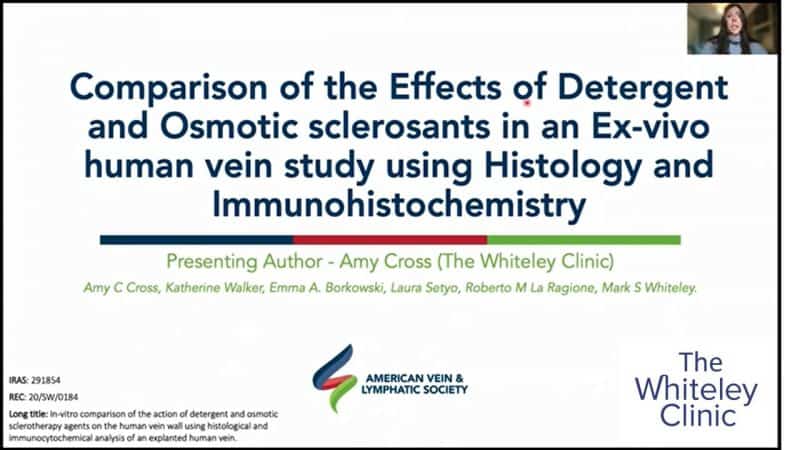 Amy Cross of Whiteley Clinic wins best research presentation by a trainee in conference at the AVLS October 2021- comparison of sclerotherapy in varicose veins