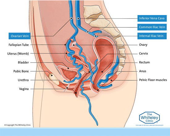 Diagram of the Female Pelvis
