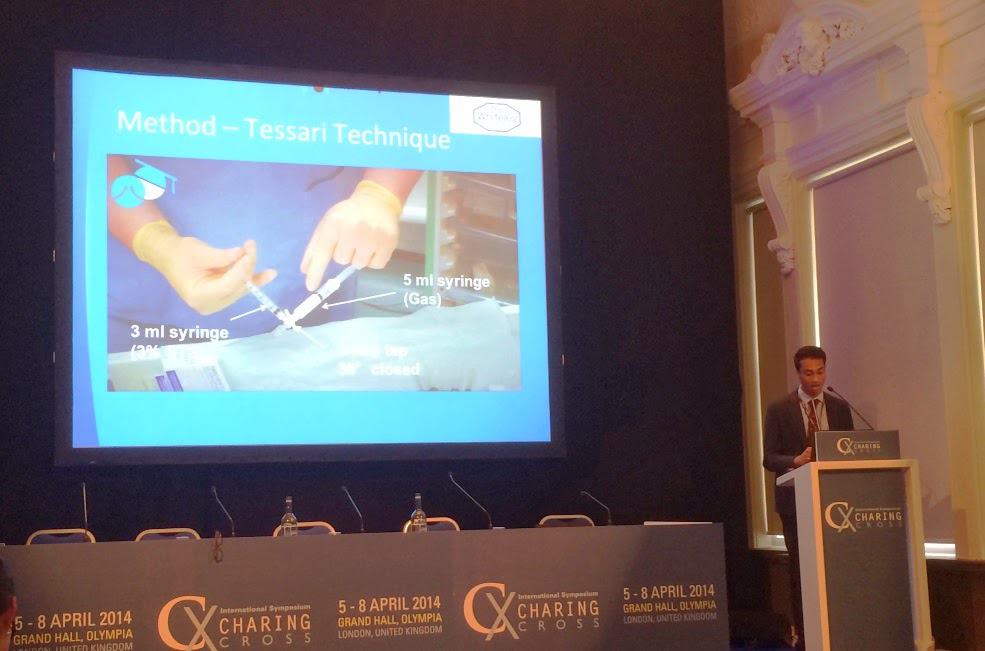 Charing Cross Symposium - Salil Patel presenting his research into Foam Sclerotherapy