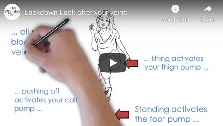Lockdown health video for vein health