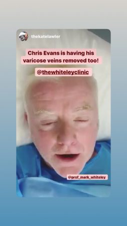 Chris Evans having his varicose veins treated with Endovenous Microwave Ablation
