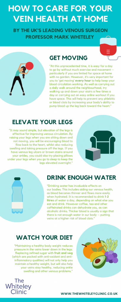 Vein health during the lockdown – how to look after your vein health – The Whiteley Clinic