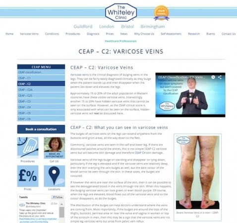 Assess your own leg veins varicose veins and spider veins on The Whiteley Clinic self assessement pages