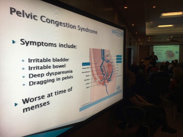 Why varicose veins come back - and how to stop them Prof Mark Whiteley lecturing at the Independent Doctors Federation at the Royal Society of Medicine 19 Jan 2016 pcs