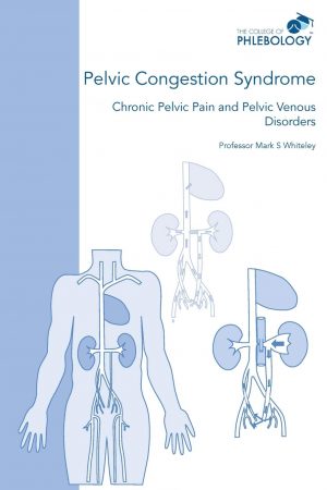 Pelvic congestion syndrome &ndash; chronic pelvic pain and pelvic venous disorders ISBN 978-1908586070
