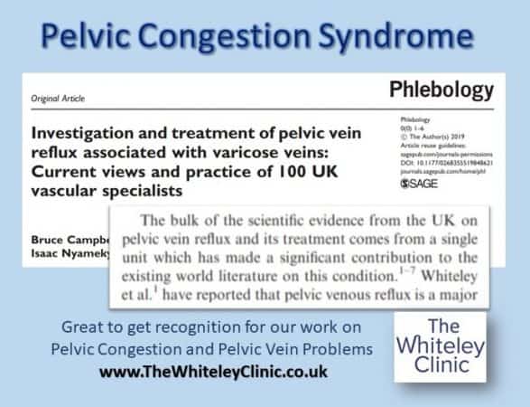 Pelvic congestion syndrome and pelvic vein reflux &ndash; Recognition for The Whiteley Clinic leading research