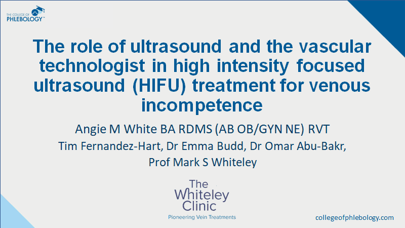 1st Prize at the SVT in Manchester November 2019 &ndash; VSSGBI meeting &ndash; HIFU in Varicose Veins