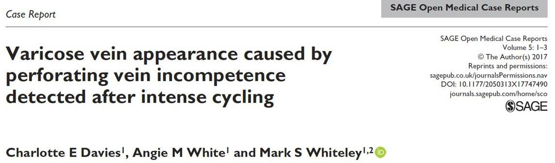 Varicose veins caused by cycling - case report from The Whiteley Clinic Dec 2017