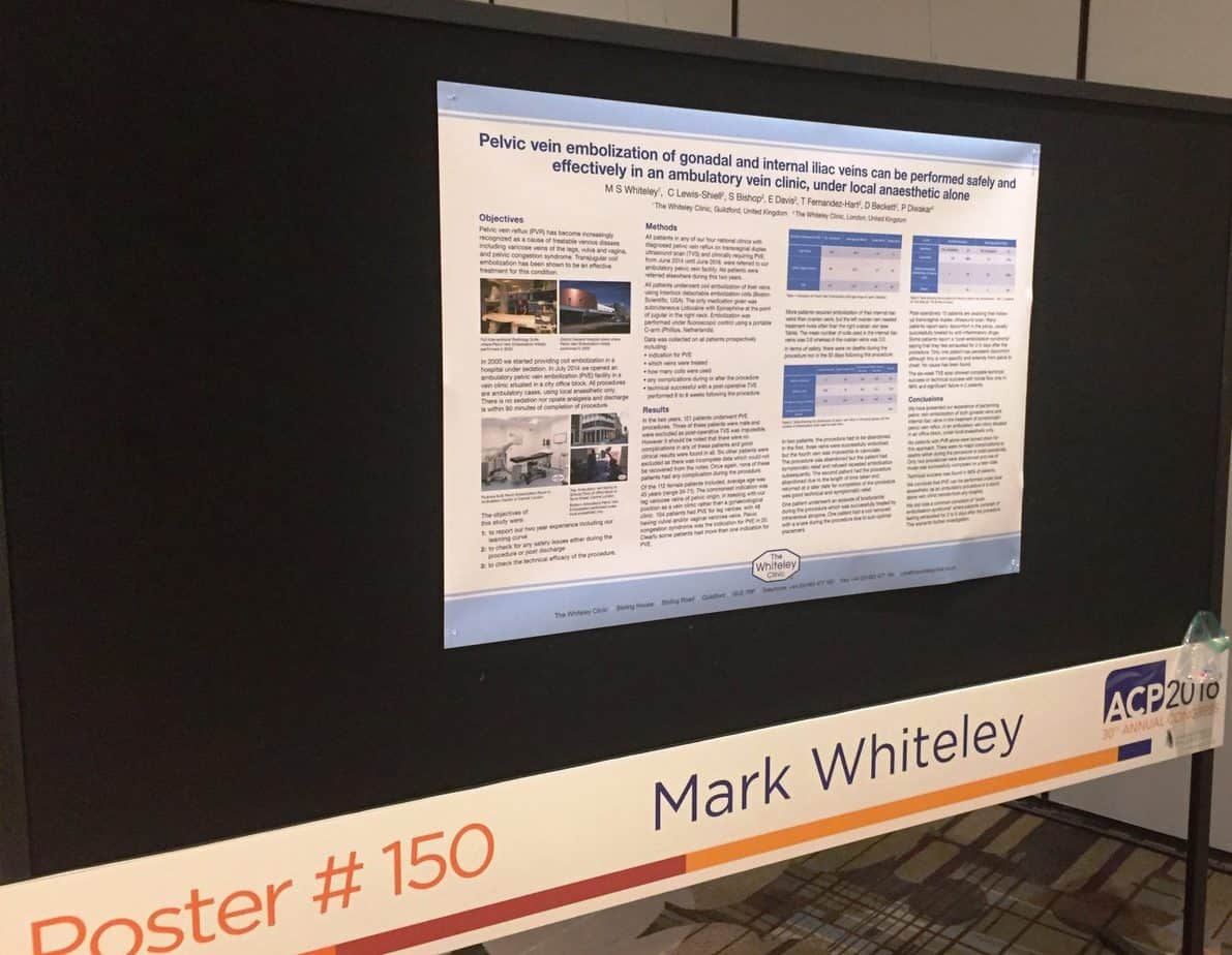 Poster on treating pelvic varicose veins under local anaesthetic as a walk-in, walk-out procedure at The Whiteley Clinic
