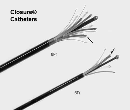 Original VNUS Closure catheters used for first endovenous varicose veins surgery in UK by Mark Whiteley and Judy Holdstock