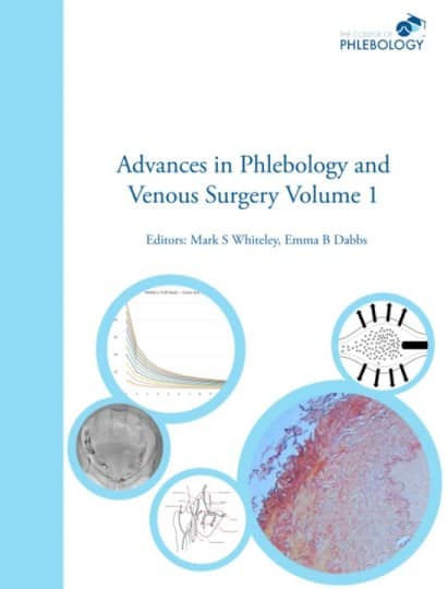 Advances in Phlebology and Venous Surgery Volume 1 - Paperback - Editors Whiteley Dabbs ISBN 978-1908586032