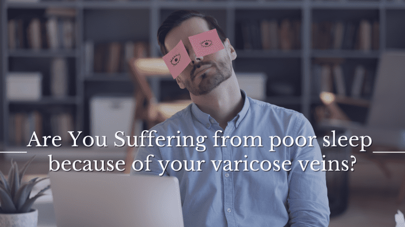 How to Sleep With Varicose Veins Without Night Pain