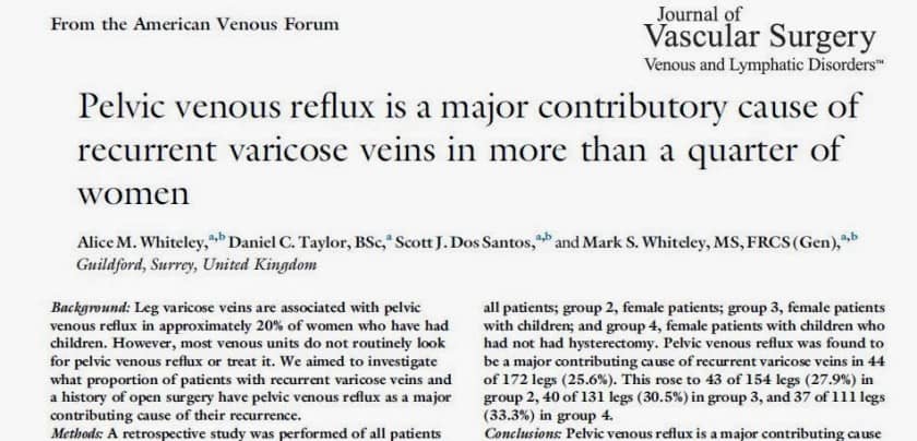Recurrent Varicose Veins due to Missed Pelvic Varicose Veins in more than 1 in 4 Women - Research from The Whiteley Clinic