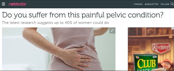 Pelvic Congestion Syndrome Dr David Beckett of The Whiteley Clinic on Netdoctor