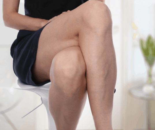 Varicose Veins are more than just a cosmetic disorder!