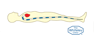 Animation of venous flow when lying down