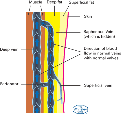 How veins work - Blood flow Diagram