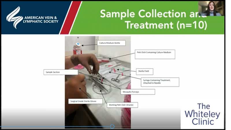 Amy Cross of Whiteley Clinic wins best research presentation by a trainee in conference at the AVLS Oct 2021- comparison of sclerotherapy in varicose veins