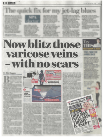 The Mail on Sunday – Now blitz those varicose veins at The Whiteley Clinic
