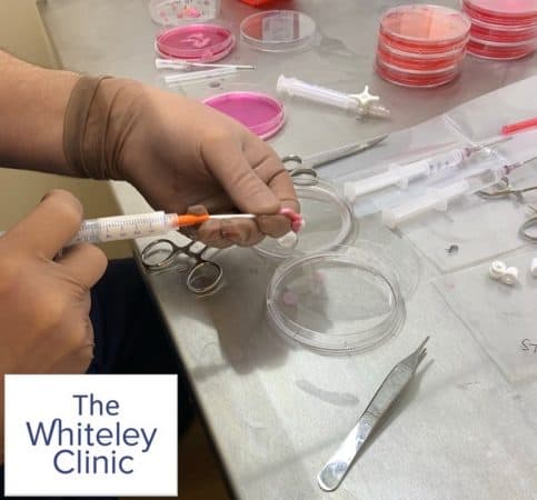 Testing foam sclerotherapy in veins at The Whiteley Clinic research laboratory into venous disease and treatements