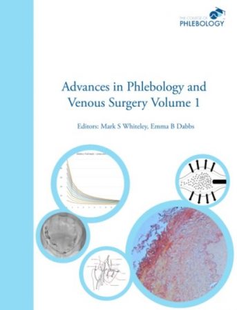Advances in Phlebology and Venous Surgery Volume 1 - Paperback - Editors Whiteley Dabbs ISBN 978-1908586032