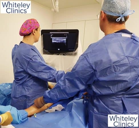 Venclose radiofrequency ablation at The Whiteley Clinic - Prof Mark Whiteley 19 November 2018