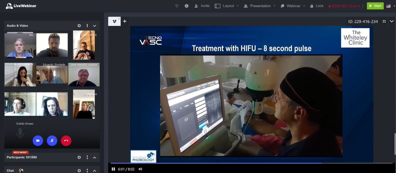 Mark Whiteley doing a HIFU treatment for varicose veins for Technovasc conference 2020