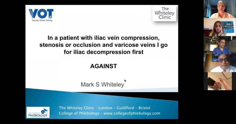 Online debate about varicose veins treatments during the Covid Crisis Mark Whiteley presenting his views about varicose veins with iliac veins compression