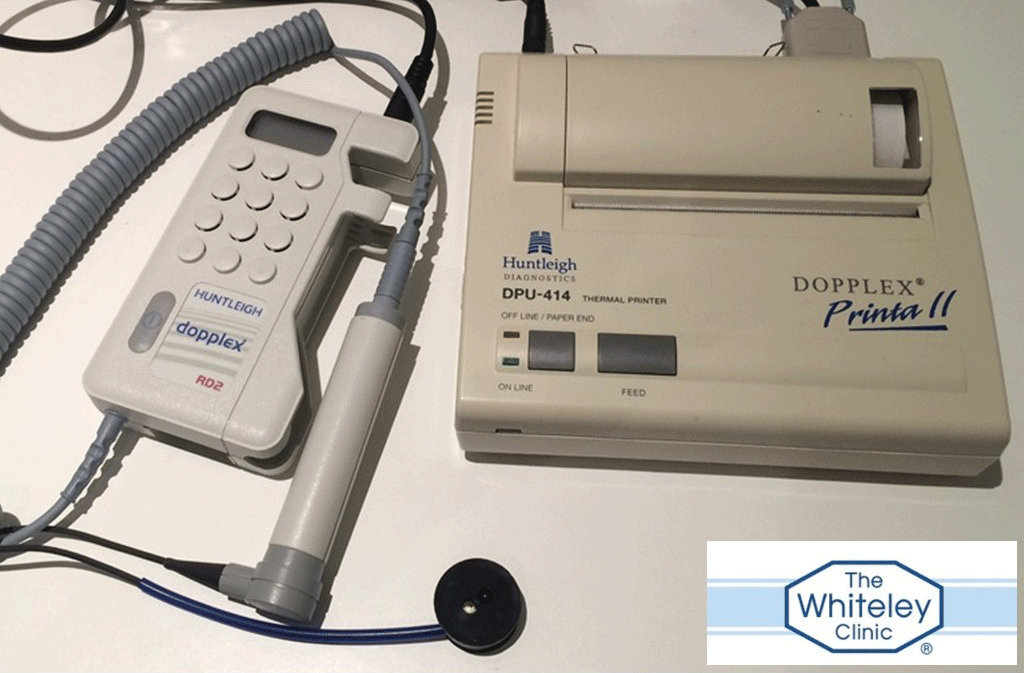 Photoplethysmography (PPG) device to measure pressure changes inside legs with varicose veins