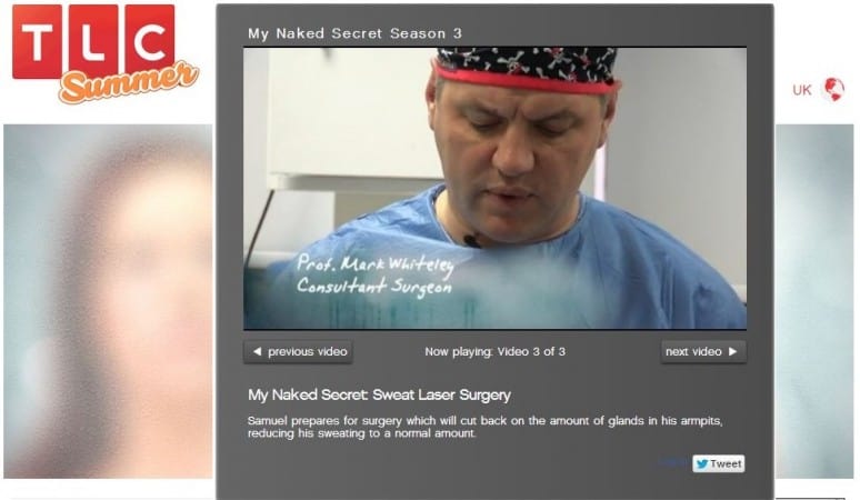 LSA for Under-arm Sweating on TV