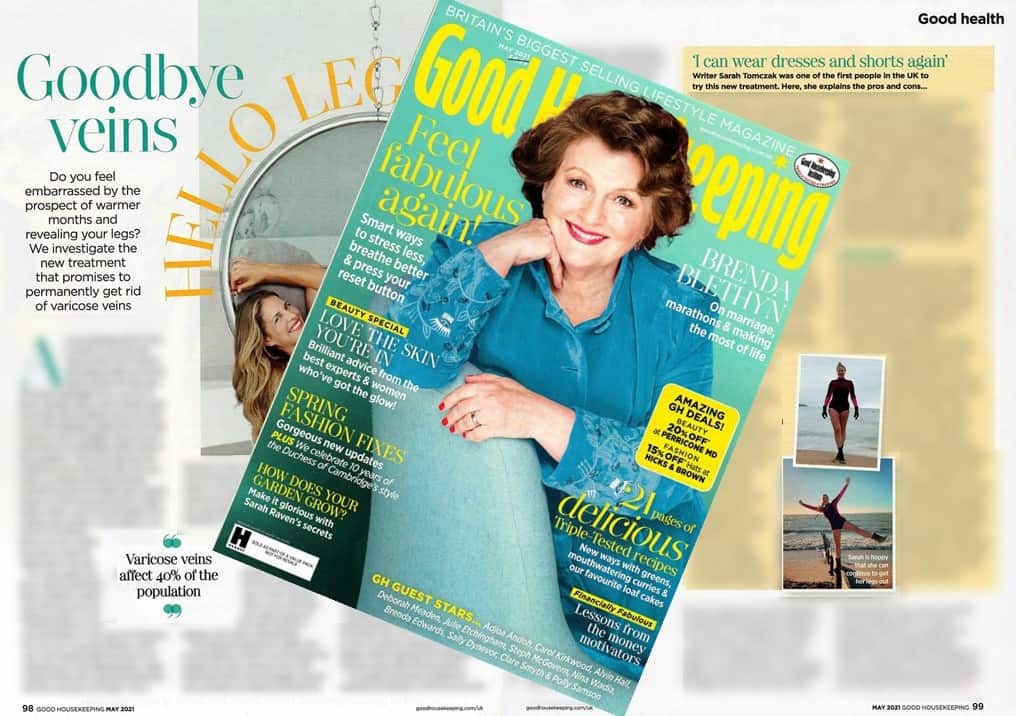 Sonvein HIFU treatment of Varicose Veins at The Whiteley Clinic in Good Housekeeping May 2021