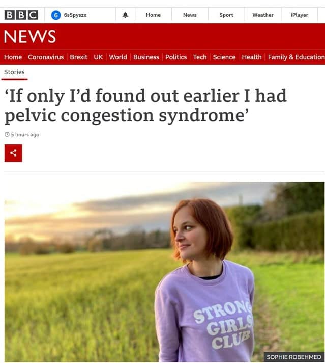 BBC article on Pelvic Congestion 20 years after The Whiteley Clinic started treating it