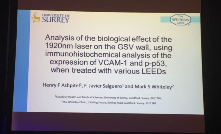 Title slide of top UK prize winning varicose veins research invited to The American Venous Forum Feb 2016